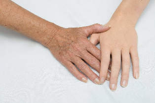 odmłodzenie skóry rąk